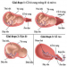 Phương pháp “ Truyền oxytocin ở sản phụ đủ tháng ối vỡ sớm” tại khoa Sản Bệnh viện A Thái Nguyên.